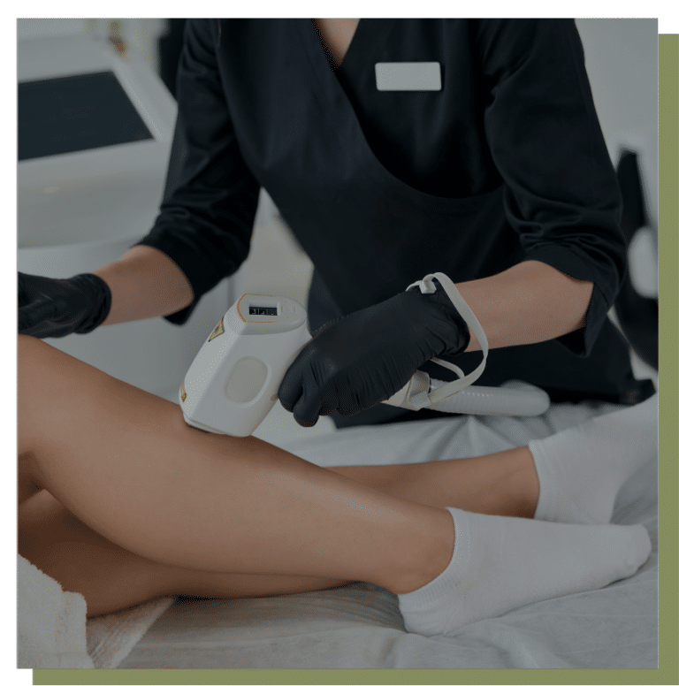 épilation laser